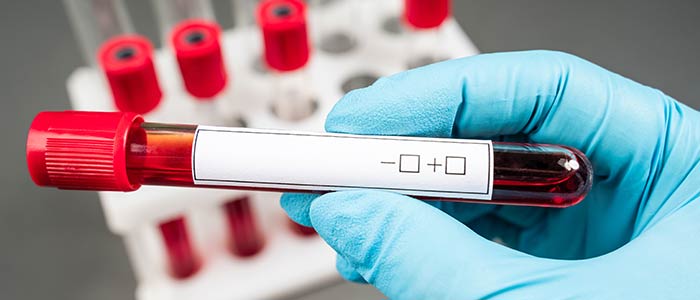 Diabetes and Cholesterol Screening in Laurel, MD Diabetes and Cholesterol Screening in Laurel, MD
