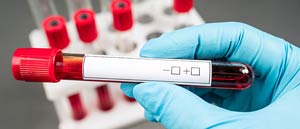 Diabetes and Cholesterol Screening in Laurel, MD Diabetes and Cholesterol Screening in Laurel, MD