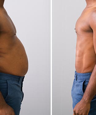 Semaglutide at The Wellness NPs in Laurel MD