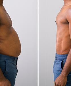 Semaglutide at The Wellness NPs in Laurel MD