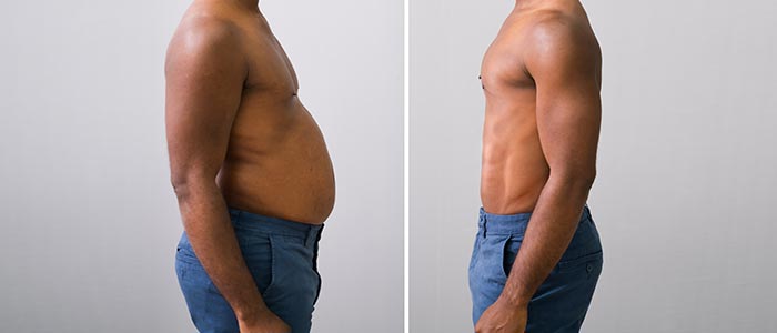Semaglutide Treatment Specialist in Laurel MD Semaglutide Treatment Specialist in Laurel MD